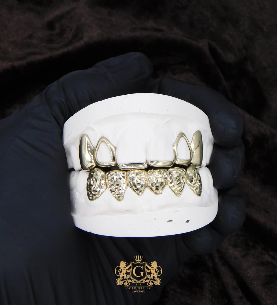 Custom gold grillz made to fit a dental model