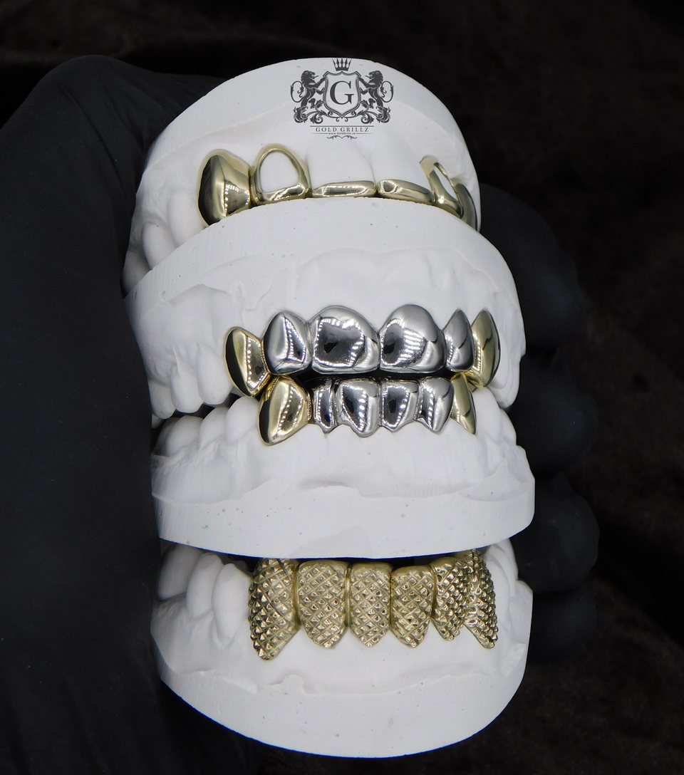 Custom yellow and white gold grillz displayed on dental models