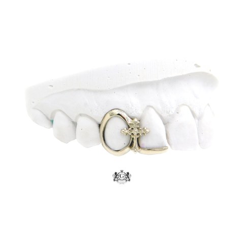 Crosslink Frame gold tooth