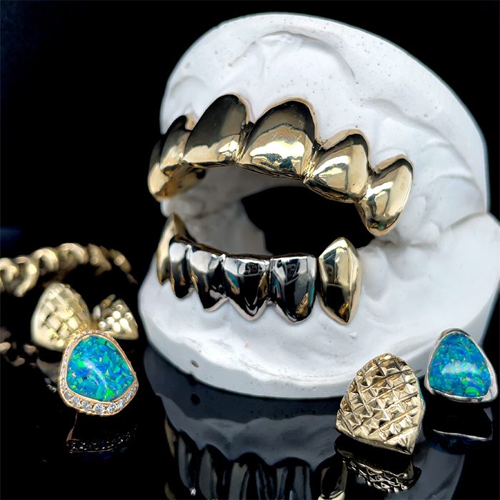 Custom gold grillz displayed on a black stand