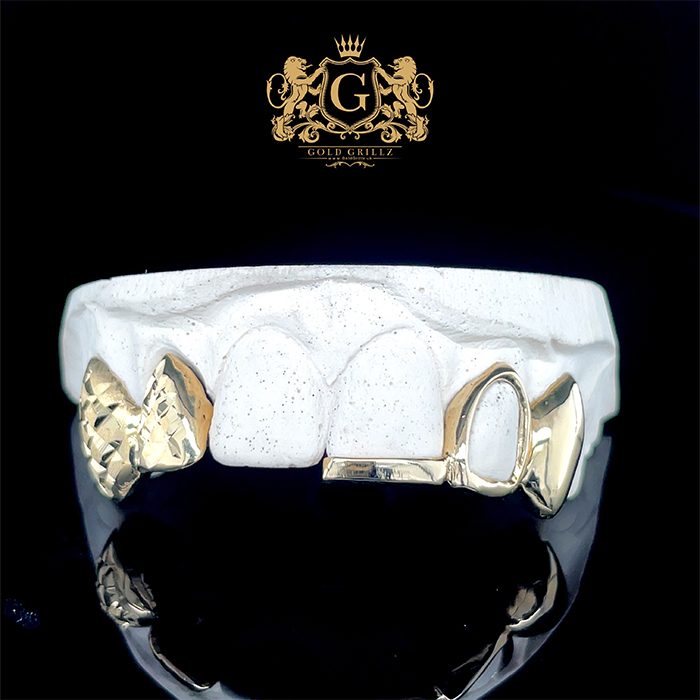Custom gold teeth arranged on a work surface