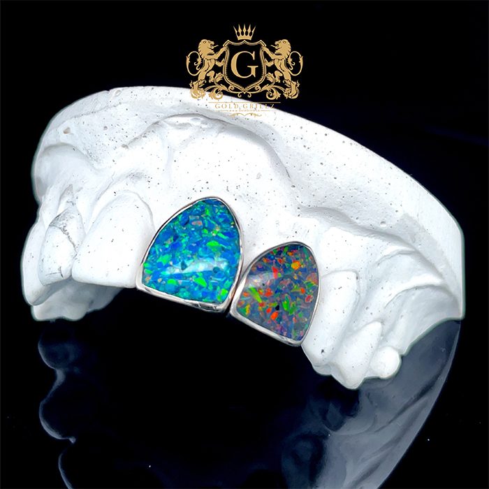Diamond-set gold grillz on a display stand