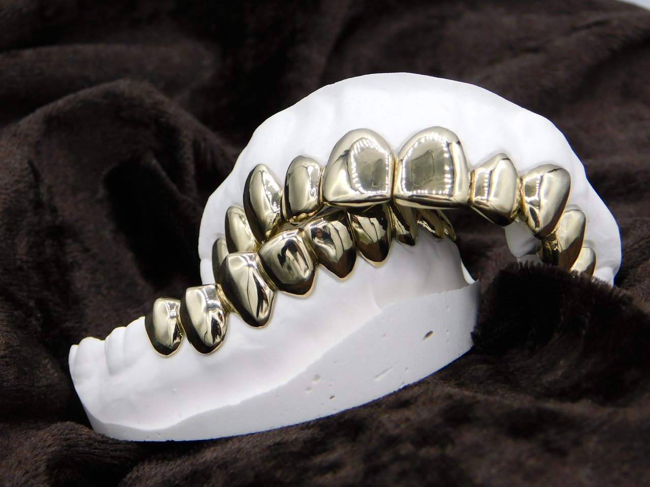 Custom gold grillz on a dental mould