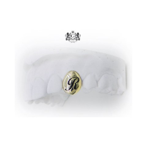 Gold Tooth with Enamel Letter