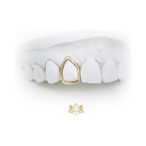 Gold Tooth – Window Design